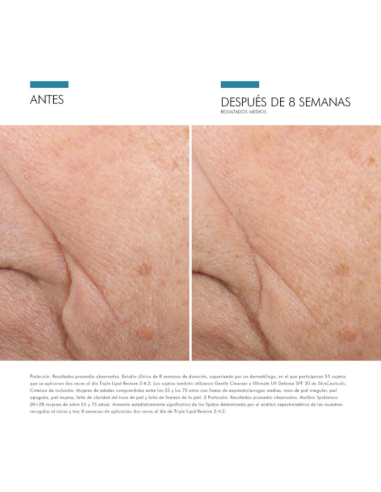 SKINCEUTICALS TRIPLE LIPID 2 4 2 48ML